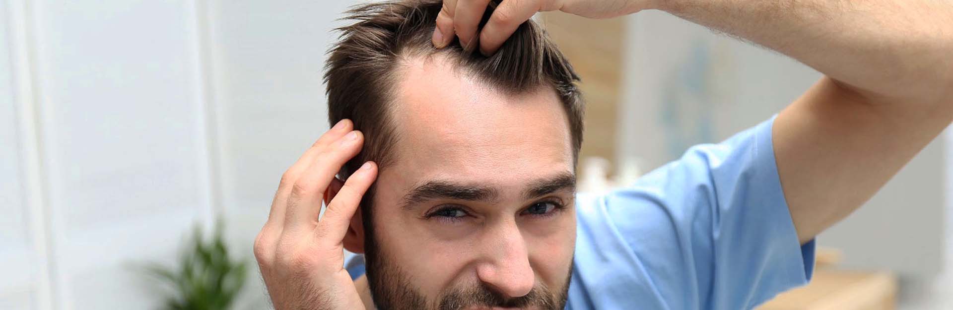 hair loss
